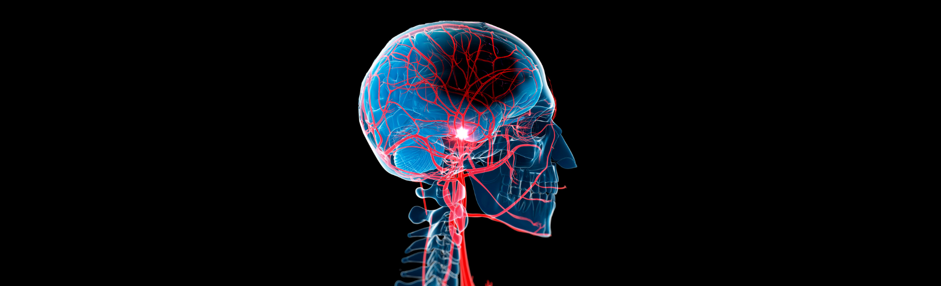 In adults 35 and younger, women are 44% more likely than men to suffer ischemic strokes — strokes caused by blood clots that travel to the brain.